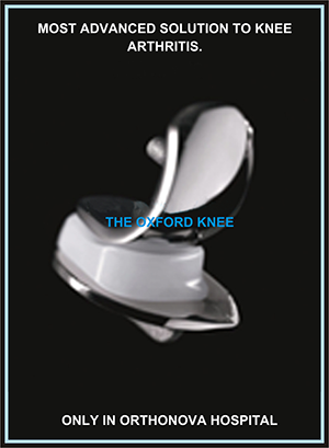 Oxford knee